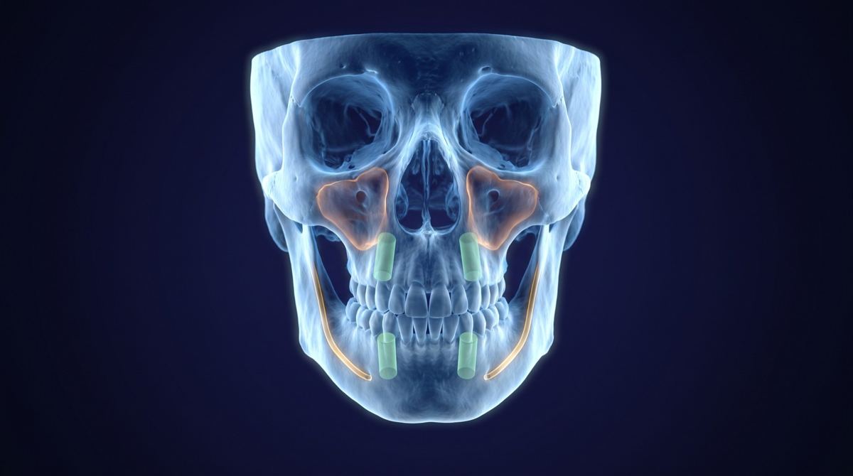 CBCT 3D scan