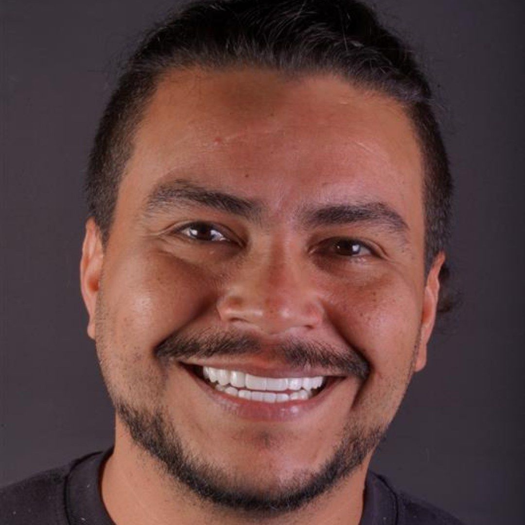 After Dental Implant