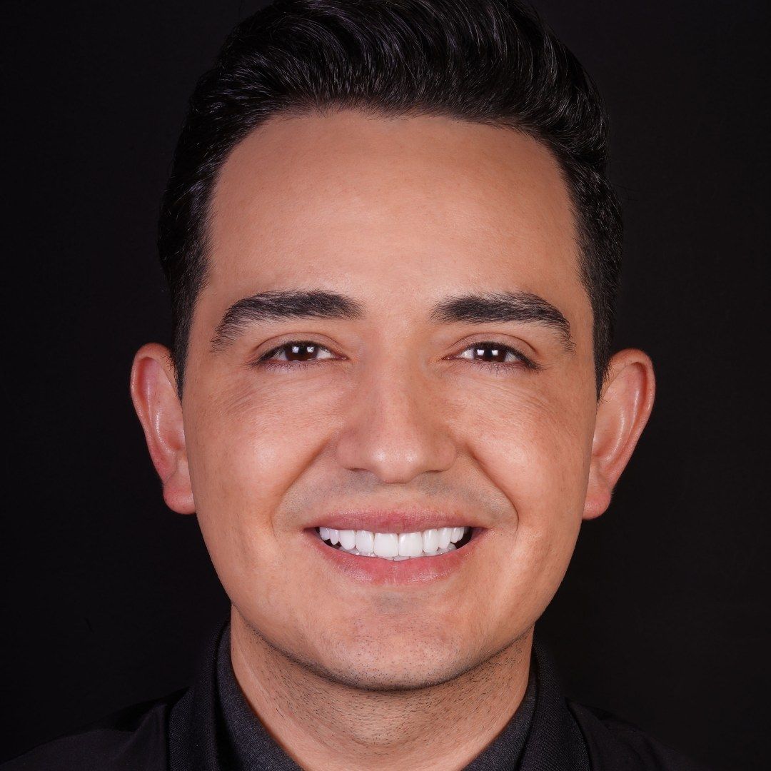 After Porcelain Veneers