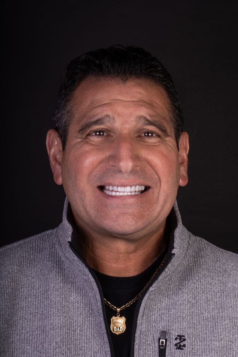 After Porcelain Veneers