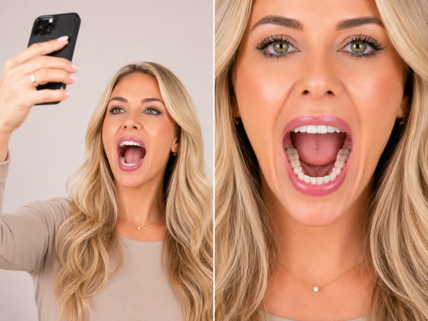 Example: lower teeth photo