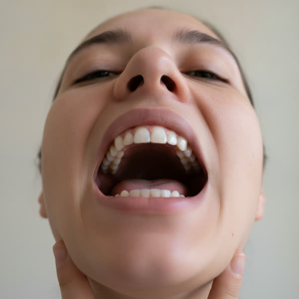 Example: upper teeth photo